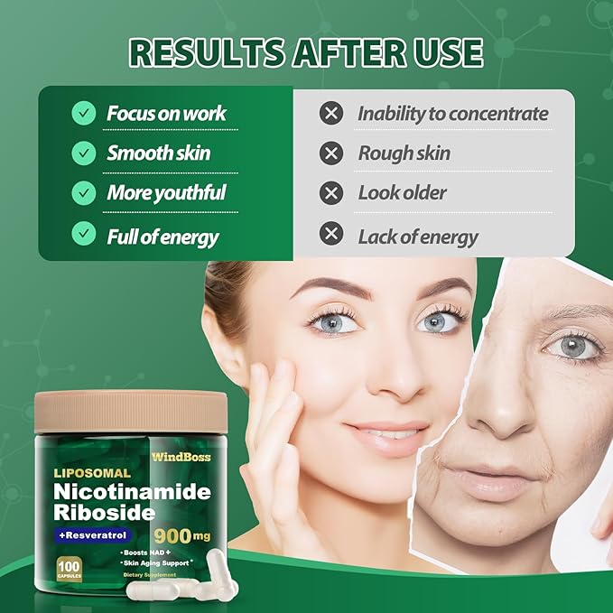 NAD Nicotinamide Riboside Resveratrol, Liposomal NAD Supplements for Women & Men, NMN Supplement Alternative, NAD Supplement - 100 Capsules - 2pcs