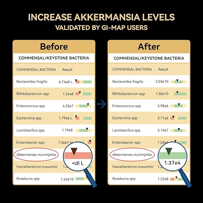 Akkermansia Probiotic, GLP-1 Supplement for Gut Health & Digestion, DigeSEB Digestive Enzymes & Vitamin B Complex - 30 Billion TFU, Third-Party Tested, 30 Capsules - 1 Month Supply for Men & Women