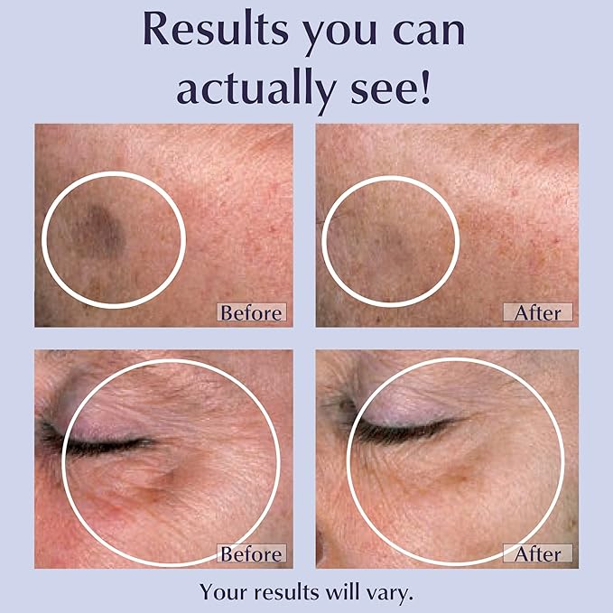 Lane Innovative - Toki Powder, Collagen Supplement for Skin, Collagen Peptides for Anti-Aging, Anti-Wrinkle Formula, Helps Reduce Age Spots, Peptides for Youthful Skin (30 Servings)