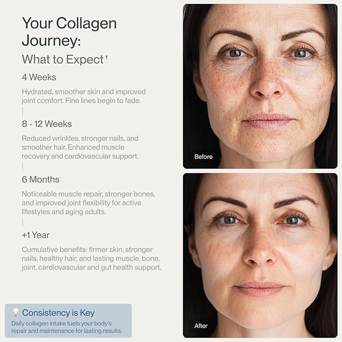 Collagen Peptides for Women & Men Grass-Fed Pasture-Raised Hydrolyzed Collagen Powder Type 1 & 3 for Skin, Hair, Nails and Joints, Non-GMO, Paleo & Keto, Unflavored,10 Fl oz. 30 Servings