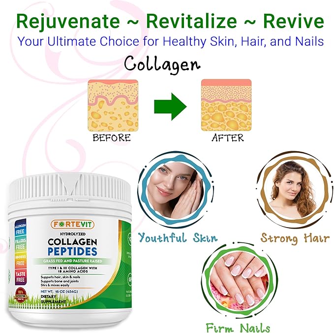 FORTEVIT Hydrolyzed Collagen Peptides Powder - Boosts Skin Elasticity, Strengthens Hair & Nails, Supports Joint Mobility - Unflavored, Non-GMO, Sugar-Free, Keto & Paleo-Friendly (16oz Jar)