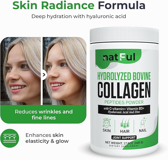 Collagen Peptides Powder – Hydrolyzed Bovine Collagen with Vitamin C, Hyaluronic Acid, Zinc & B3 – Type 1 & 3 Unflavored Protein Powder for Women & Men Hair, Skin, Nails, Joints 45 Servings