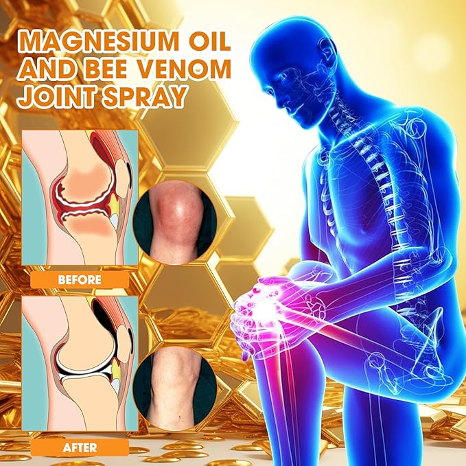 Magnesium Joint Spray, Professional Magnesium Joint Oil,Magnesium Oil & Bee Venom Joint Spray for Back, Knee, Hands, Neck (1 PCS,100ml)