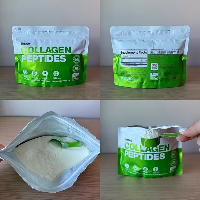 Hydrolyzed Collagen Peptides Supplement for Women & Men - Joint, Hair, Skin & Nails Support - Grass Fed Type I & III - Keto, Paleo - 28 Servings, 9.88 oz, Unflavored Powder