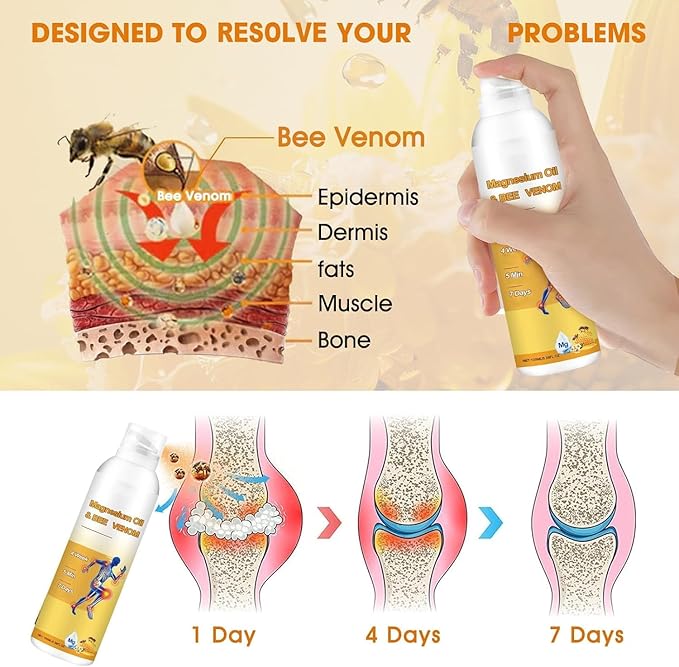 Magnesium Joint Spray, Professional Magnesium Joint Oil,Magnesium Oil & Bee Venom Joint Spray for Back, Knee, Hands, Neck （1 PCS,100ml）