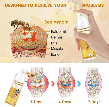 Magnesium Joint Spray, Professional Magnesium Joint Oil,Magnesium Oil & Bee Venom Joint Spray for Back, Knee, Hands, Neck （1 PCS,100ml）