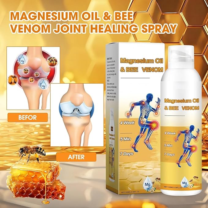Magnesium Joint Spray, Professional Magnesium Joint Oil,Magnesium Oil & Bee Venom Joint Spray for Back, Knee, Hands, Neck （1 PCS,100ml）