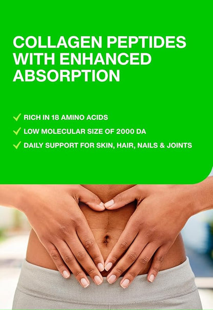Hydrolyzed Collagen Peptides Supplement for Women & Men - Joint, Hair, Skin & Nails Support - Grass Fed Type I & III - Keto, Paleo - 14 Servings, 4.9 oz, Unflavored Powder