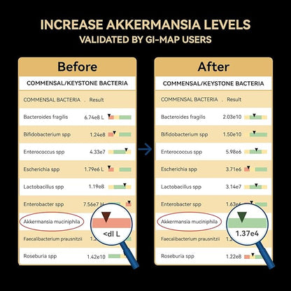 Akkermansia Probiotic, GLP-1 Supplement for Gut Health & Digestion, DigeSEB Digestive Enzymes & Vitamin B Complex - 30 Billion TFU, Third-Party Tested, 30 Capsules - 1 Month Supply for Men & Women