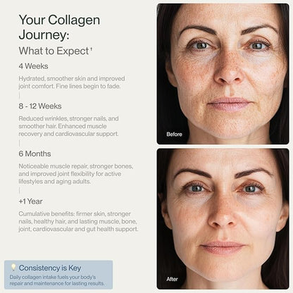 Collagen Peptides for Women & Men Grass-Fed Pasture-Raised Hydrolyzed Collagen Powder Type 1 & 3 for Skin, Hair, Nails and Joints, Non-GMO, Paleo & Keto, Unflavored,10 Fl oz. 30 Servings