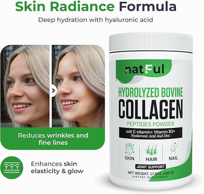 Collagen Peptides Powder – Hydrolyzed Bovine Collagen with Vitamin C, Hyaluronic Acid, Zinc & B3 – Type 1 & 3 Unflavored Protein Powder for Women & Men Hair, Skin, Nails, Joints 45 Servings