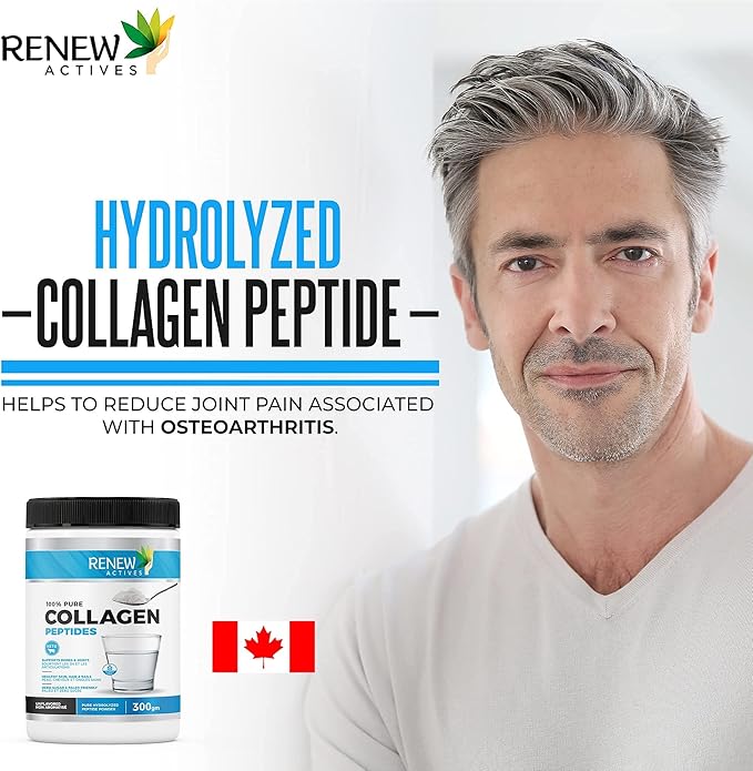 Renew Actives Hydrolyzed Collagen Peptides Powder 10G per Serving – Premium Grass-Fed Collagen for Skin, Joints & Hair – 9.4g Protein – Supports Collagen Formation & Muscle Recovery – Made in Canada