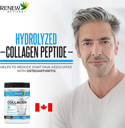 Renew Actives Hydrolyzed Collagen Peptides Powder 10G per Serving – Premium Grass-Fed Collagen for Skin, Joints & Hair – 9.4g Protein – Supports Collagen Formation & Muscle Recovery – Made in Canada