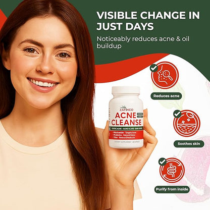 Acne Cleanse Capsules.Powerful Vitex Angus Extract, Niacinamide, Biotin for Teens & Adults. Organic Acne Treatment,Cystic Pimples, Oily Skin to Natural Clear Skin Vitamins Supplement- 60 Count