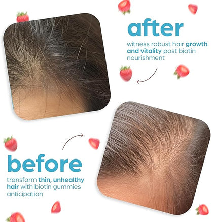 Artnaturals Biotin Gummies for Hair Growth - (100 Gummies - 10000mcg) - Natural Strawberry Vitamins Supports Nails and Skin - Gelatin, Gluten, Nut and Egg Free