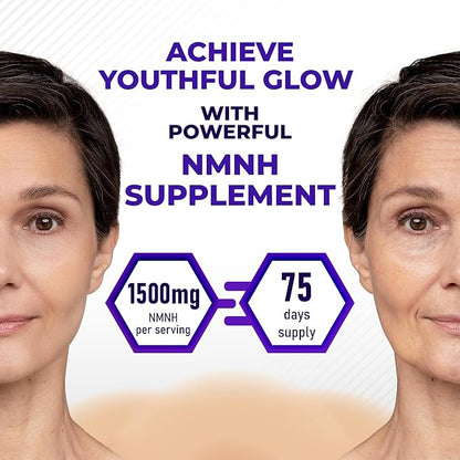 High Potency NMNH with Resveratrol, Quercetin, Green Tea, Milk Thistle, Turmeric & Rhodiola Rosea – Supports Cellular Wellness & Anti-Aging* – Made in The USA