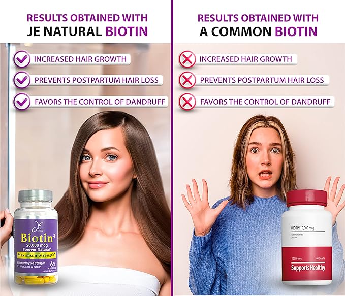 Biotin Hair Skin and Nails Vitamins, Vitamin C, Biotin and Collagen Supplements That Make Hair Grow Faster and Longer, for All Ages, 60 Capsules of Biotin 20000mcg Maximum Strength.